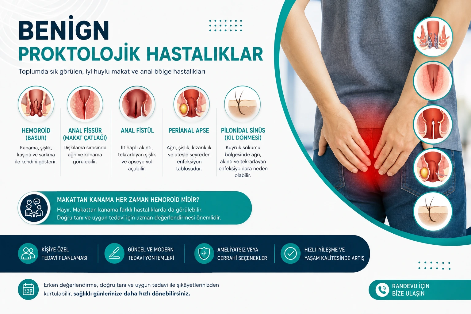 Benign Proktolojik Hastalıklar: Hemoroid, Anal Fissür, Anal Fistül ve Pilonidal Sinüs
